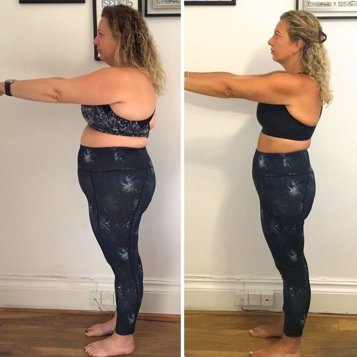 Referência visual de antes e depois, mulher de perfil